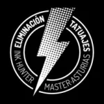 Eliminación de Tatuajes